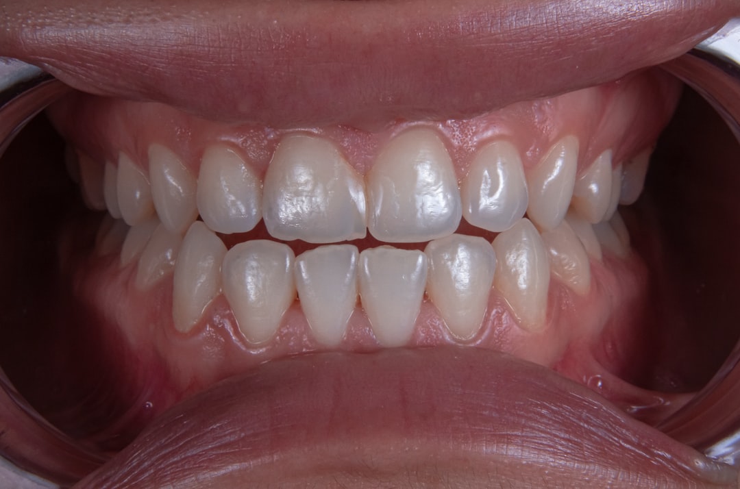 Photo bleaching